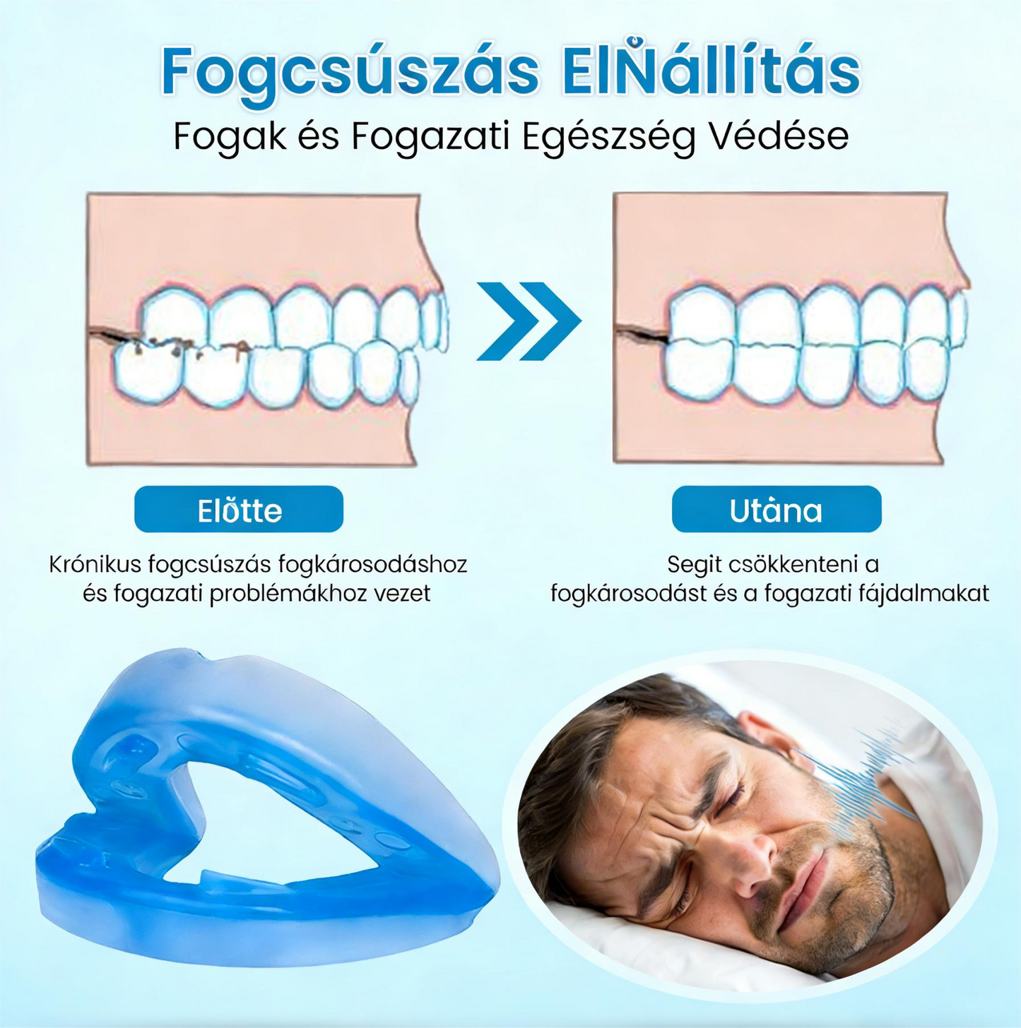 🎁Vásárolj 1 kapsz 1 ingyen😴Horkolásgátló szájbetét – Csökkentse a horkolást már az első éjszakától! 🛏️CPAP/MAD Alternatíva – 180 Napos Garancia!（副本）
