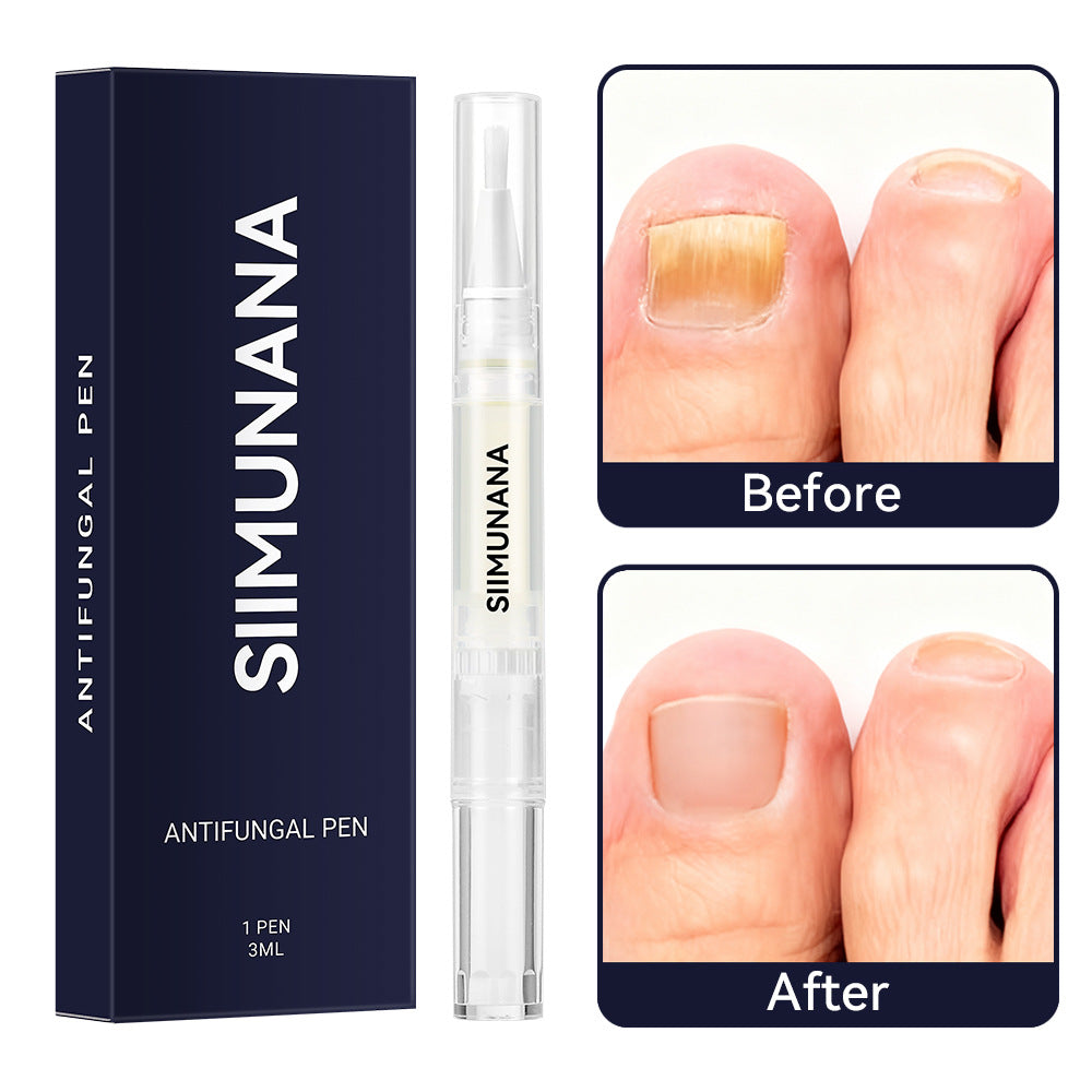 😀Vásárolj 1 kapsz 1 ingyen🦠25% undecilénsav tartalmú gombaellenes toll – precíz alkalmazás + eredmények 7 nap alatt!